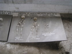 skeletal display