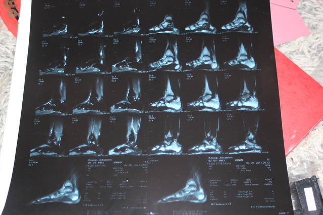 X- ray plate - free image